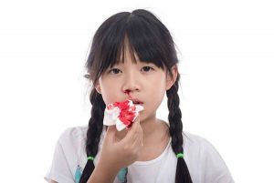 Trẻ em bị chảy máu mũi là bệnh gì? Nguyên nhân, cách xử lý 