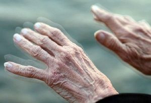Giải đáp thắc mắc: Bệnh Parkinson có di truyền không?