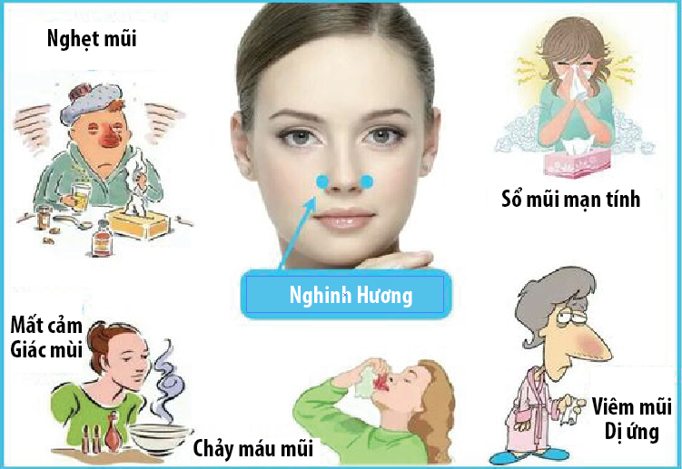 day huyệt nghinh hương chữa viêm mũi dị ứng cho trẻ
