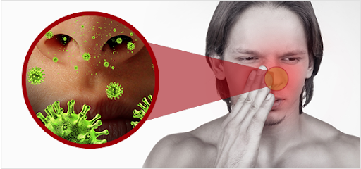 Mối liên quan giữa bệnh viêm mũi dị ứng và hen suyễn như thế nào?