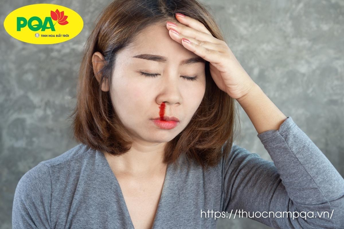 Chảy máu cam đau đầu là triệu chứng viêm mũi dị ứng