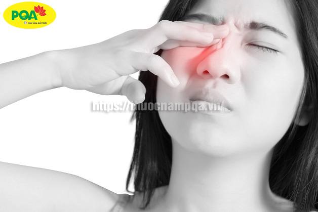 Viêm xoang đau hốc mắt có nguy hiểm không? Cách nhận biết sớm