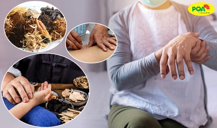 Hiểu rõ bệnh Parkinson theo Y học cổ truyền Hiểu rõ bệnh Parkinson theo Y học cổ truyền